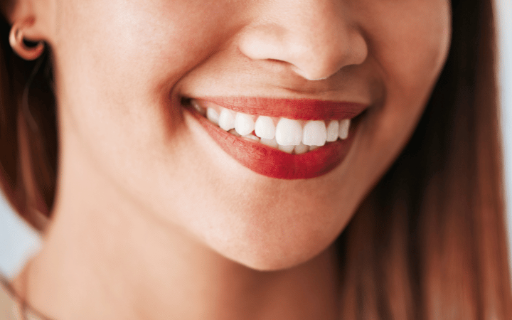 Cosmetic Dentistry Burwood - SIA Dental Burwood